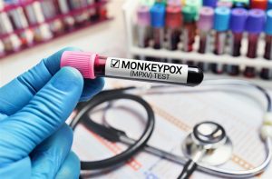 Lo reiteró la Academia Nacional de Medicina ¡Hay que tomar medidas por nuevos casos de viruela del mono! - FOTO