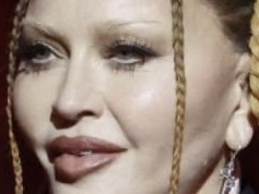 Criticaron a Madonna por abusar del botox en su rostro ????????