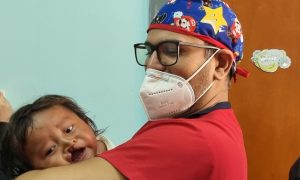 Zulia: Niños yukpas con labio hendido serán operados