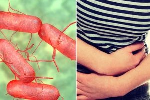 Médicos advierten emergencia sanitaria tras casos de Salmonella en Venezuela