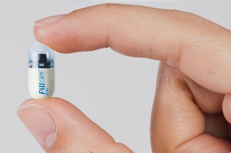 Videocápsula endoscópica facilita el diagnóstico gastrointestinal