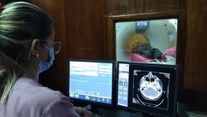 15 zulianos operados de cataratas en jornada del Plan quirúrgico nacional