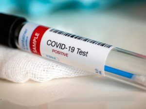 El jueves se reportaron tres nuevos casos de covid-19 en el país