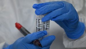 Venezuela registró 13 nuevos casos de Covid-19 este miércoles