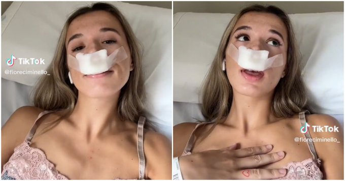 ¿What? Joven tiktoker se hace rinoplastia para que sus hijos 'nazcan con linda nariz'