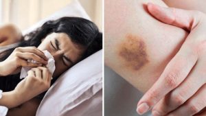 Los médicos le diagnosticaron amigdalitis pero al buscar en Internet descubrió otra cosa