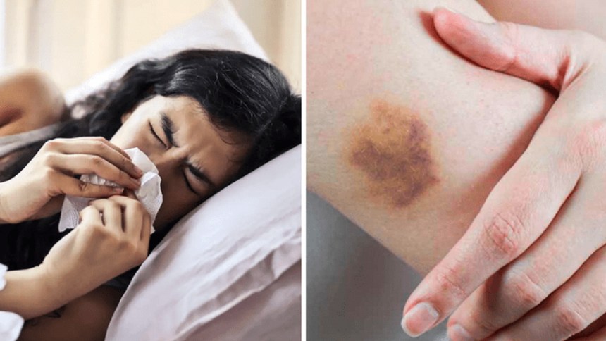 Los médicos le diagnosticaron amigdalitis pero al buscar en Internet descubrió otra cosa