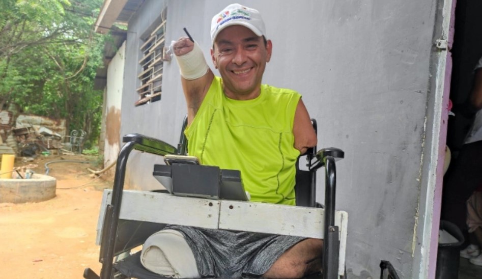 La conmovedora historia de Elvis Sanabria que quedó sin brazos ni piernas: “Le doy gracias a Dios”ios”