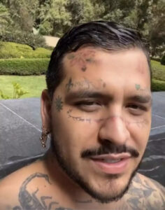 Christian Nodal mostró el avance de su tratamiento para eliminar tatuajes