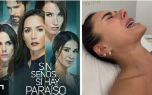 Actriz de Sin senos sí hay paraíso mostró la dolorosa cirugía estética que afrontó para remodelar su cuerpo
