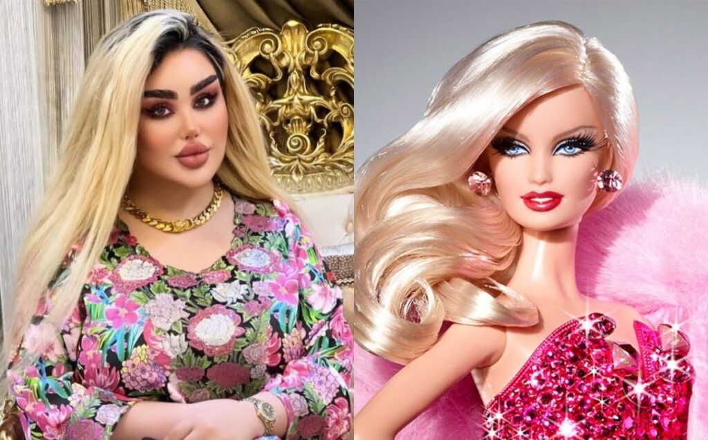 Mujer se sometió a más de 40 cirugías para parecerse a “Barbie” 💉👄