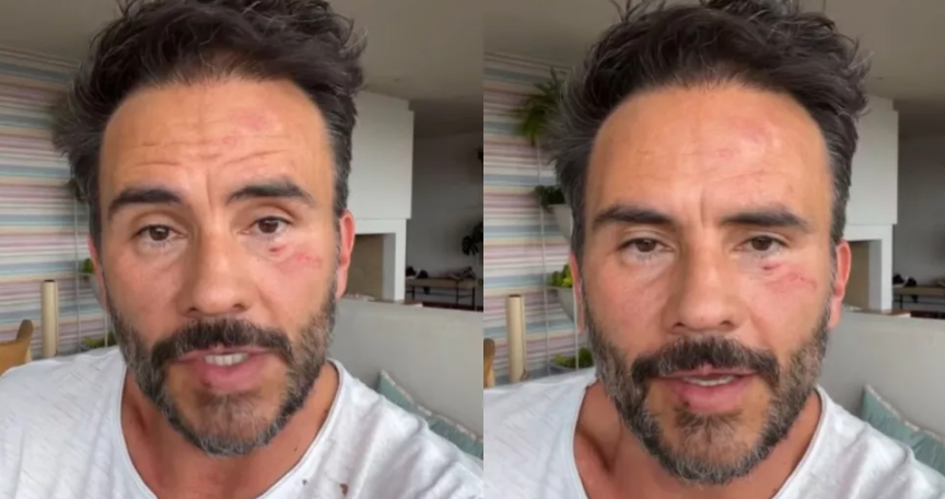 Golpearon y robaron al actor Juan Pablo Raba