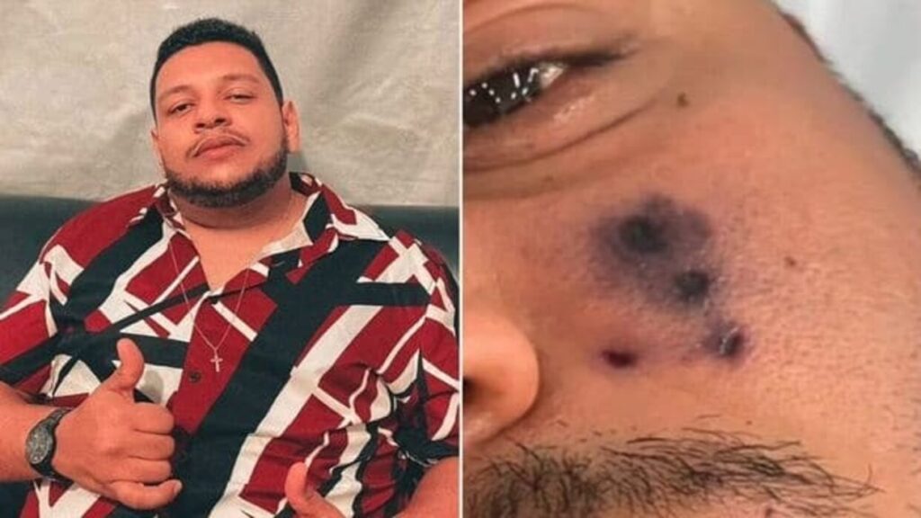 Muere el cantante Darlyn Morais a los 28 años tras ser mordido por una araña