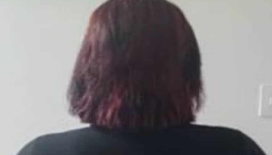 Detienen a falsa cirujana plástica en Anzoátegui que realizaba procedimientos de estética y cobraba 400 dólares