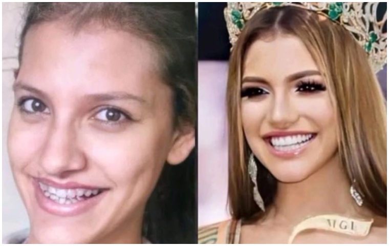 Miss Grand International 2019, Valentina Figuera confiesa la cantidad de cirugías estéticas que se ha realizado