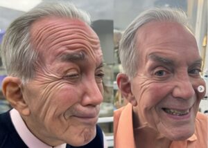 ¡Sensacional! A sus 81 años, Gilberto Correa se hace unos retoques faciales ¿Cómo se ve?