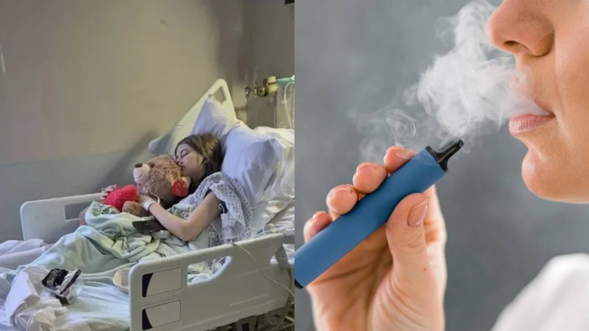 El caso de una joven de 17 años que perdió medio pulmón y casi sufre un paro cardíaco por vapear: Se puso azul