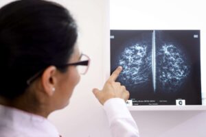 Nuevas combinaciones de medicamentos reducen la toxicidad de los tratamientos oncológicos