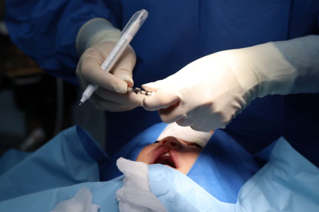 Operan a trujillanos con labio leporino