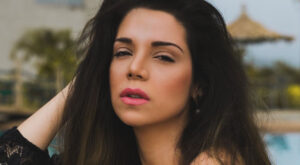 ¡Charyl Chacón sufrió grave mordida de un perro en el rostro!