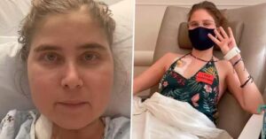 Melinda Nelson pensó que tenía una alergia, pero padecía un tipo de cáncer que afecta a una de cada un millón de personas al año