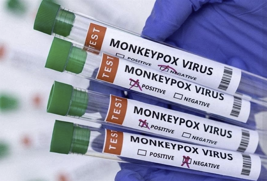 República Democrática del Congo registra más de 530 muertes por Mpox