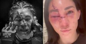 la sangrienta pelea que dejó a una luchadora de UFC con ocho puntos de sutura