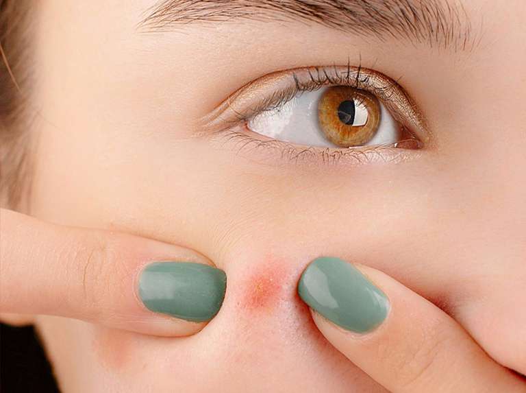 Del espejo al dermatólogo - Últimas Noticias