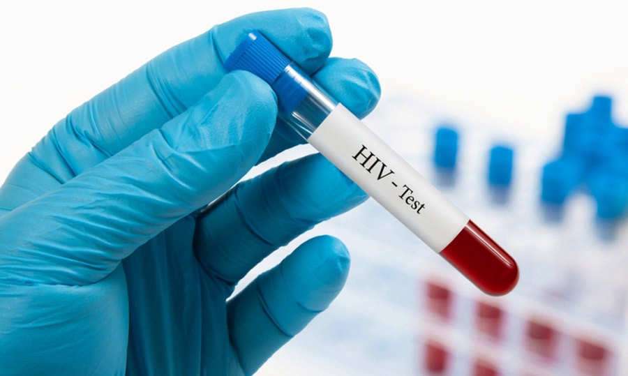 Alertan de desigualdades en la lucha contra el sida