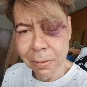 Murió diseñador luego de recibir golpiza
