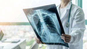 Tuberculosis causa más muertes por infección