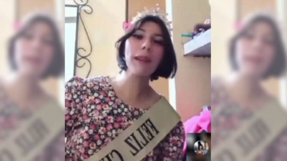 La joven zuliana con discapacidad que se prendió fuego en reto viral de TikTok