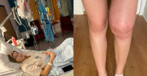 Le hicieron un mal diagnóstico y terminaron amputándole la pierna