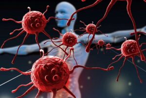 Inteligencia Artificial para diagnosticar enfermedades inmunológicas 