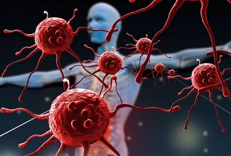 Inteligencia Artificial para diagnosticar enfermedades inmunológicas