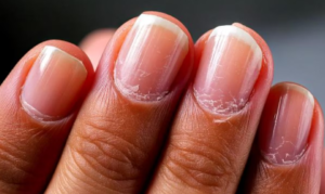 Un experto de Harvard reveló la sorprendente relación entre el crecimiento de las uñas y la longevidad