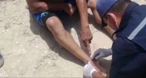 Lanzan alerta por picaduras de Raya en el Lago de Maracaibo