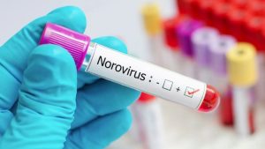 Las expectativas sobre el norovirus en 2025 y los efectos que podría causar en EEUU