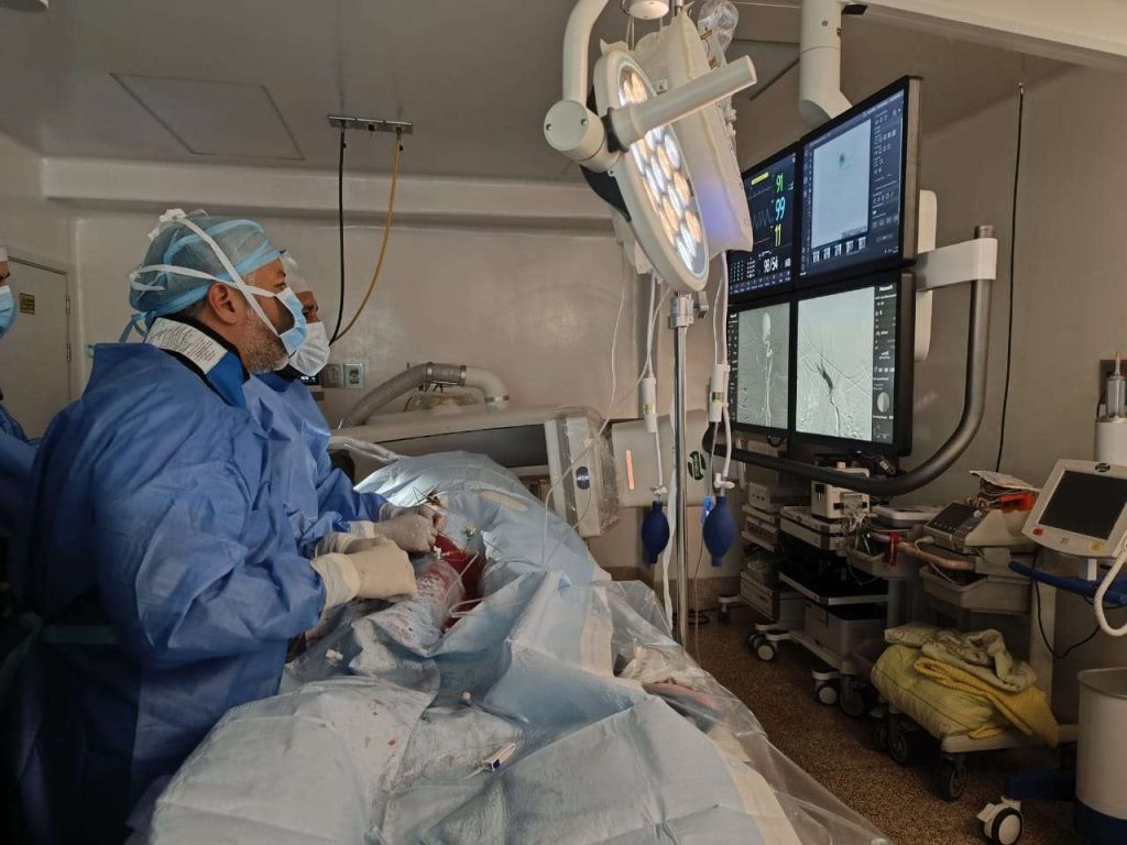 HUC reactiva neurointervenciones para aneurismas cerebrales con tecnología avanzada