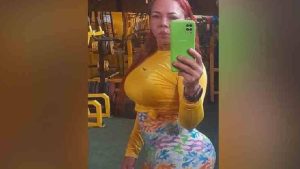 Luz Estela Machado se practicó una cirugía estética para agrandarse los glúteos y el resultado fue fatal