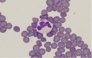 Más Allá de la Garrapata: Diagnóstico y Prevención de la Anaplasmosis Bovina, un Desafío Silencioso en el Campo