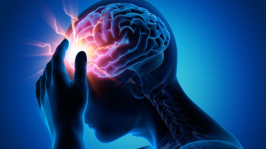 La epilepsia afecta a más de 50 millones de personas en el mundo