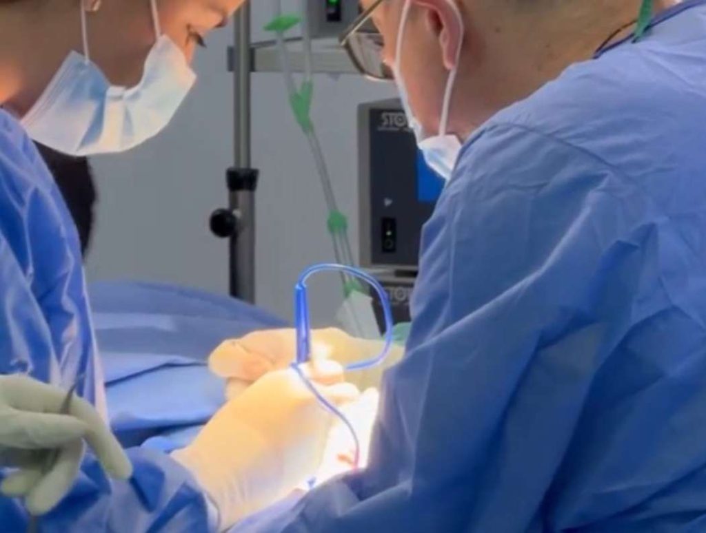 Lo que debes saber sobre la apendicitis y su tratamiento quirúrgico