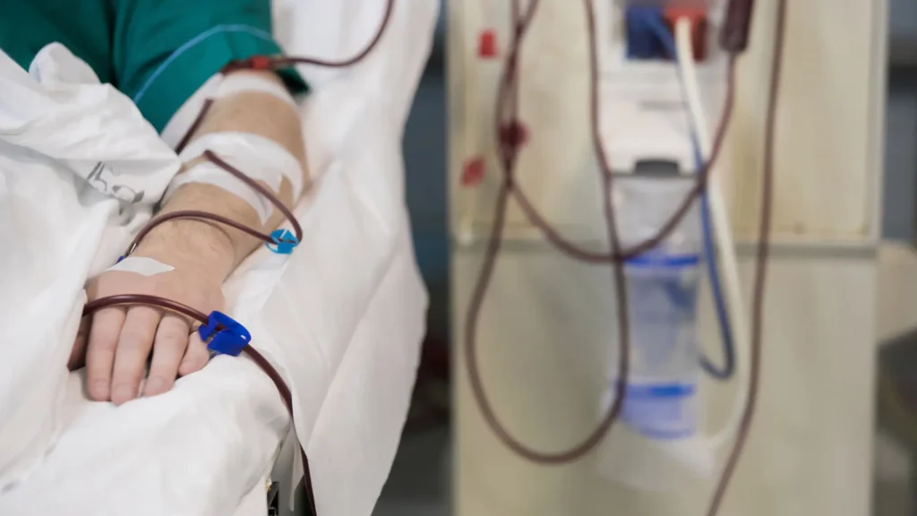 Detener la diálisis es una decisión mortal