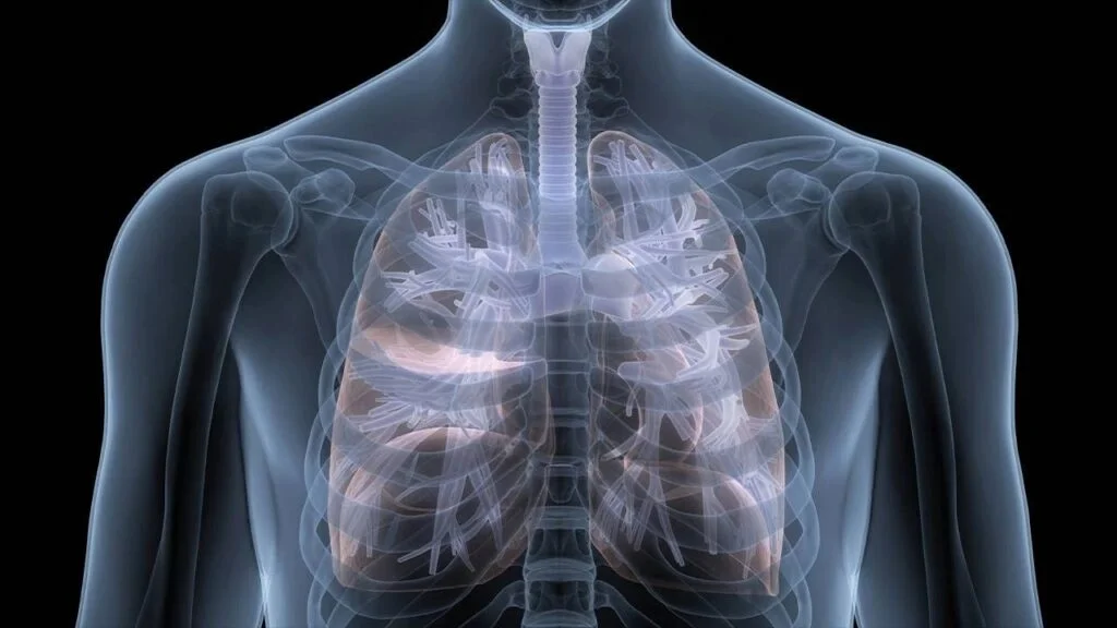 Fibrosis pulmonar es una secuela pospandemia