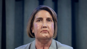 Realizan el primer trasplante de cara con donante que recibió la eutanasia