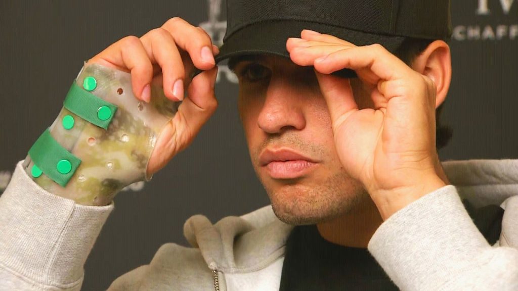 Carlos Alcaraz se perderá Roland Garros por su lesión en la muñeca