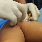 130 jóvenes reciben implantes anticonceptivos gratuitos en La Guaira