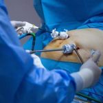 En hospitales realizan cirugías bariátricas