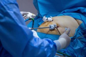 En hospitales realizan cirugías bariátricas